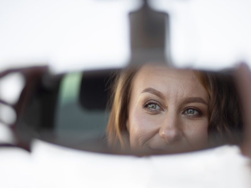 blefaroplastua superior valencia