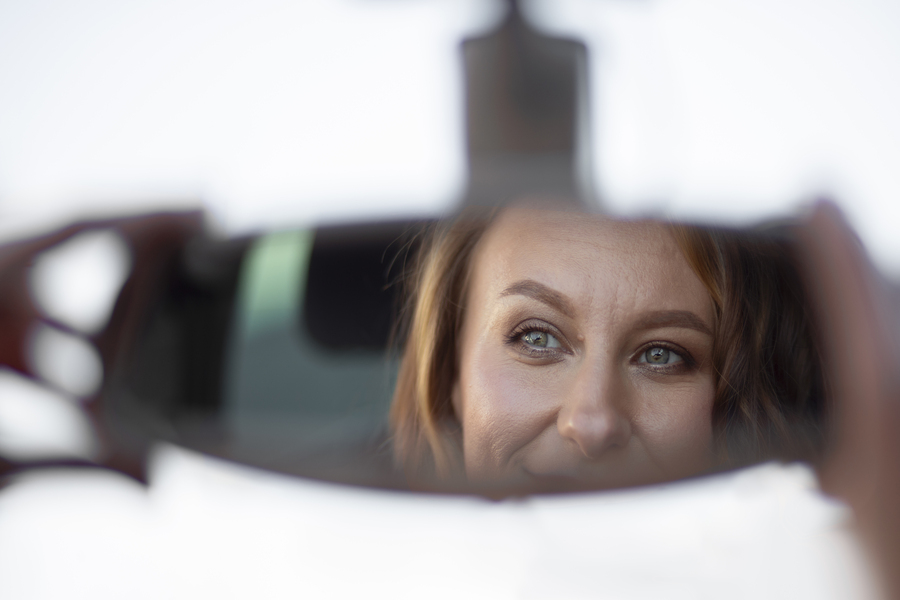 Blefaroplastia superior en Valencia: Preguntas frecuentes