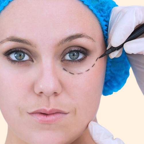 Blefaroplastia Valencia